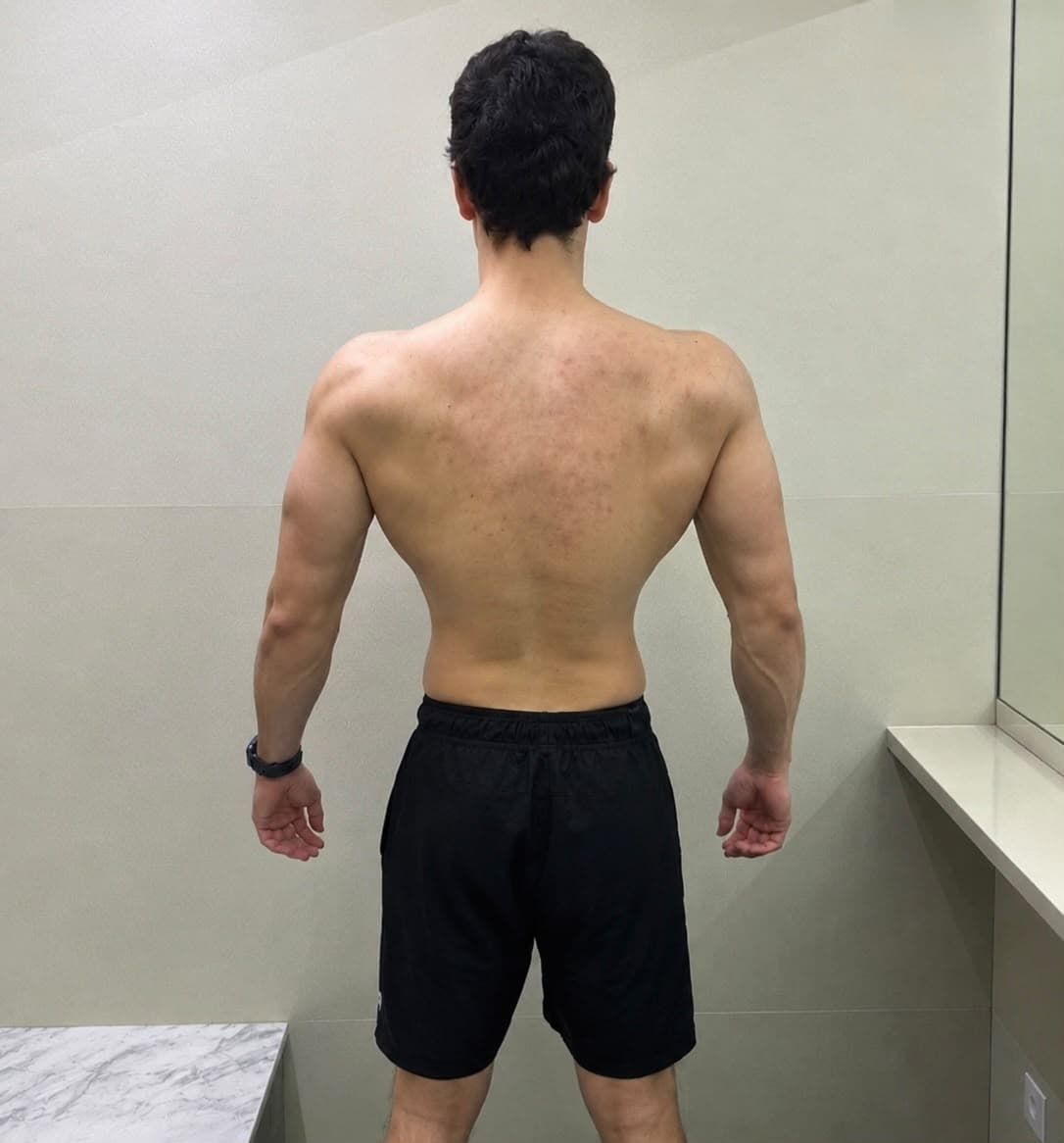 Victor depois da transformação