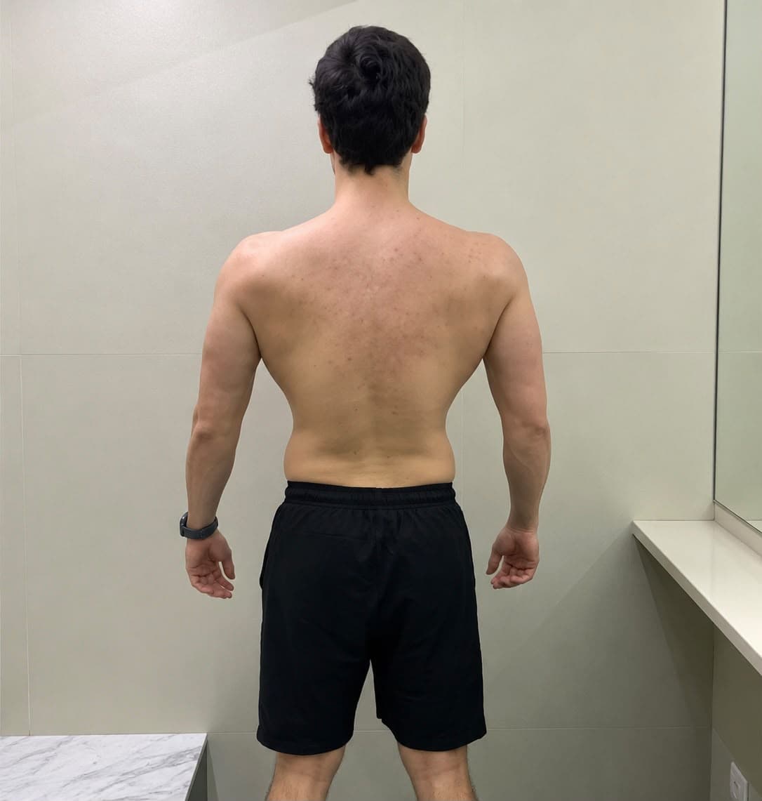 Victor antes da transformação